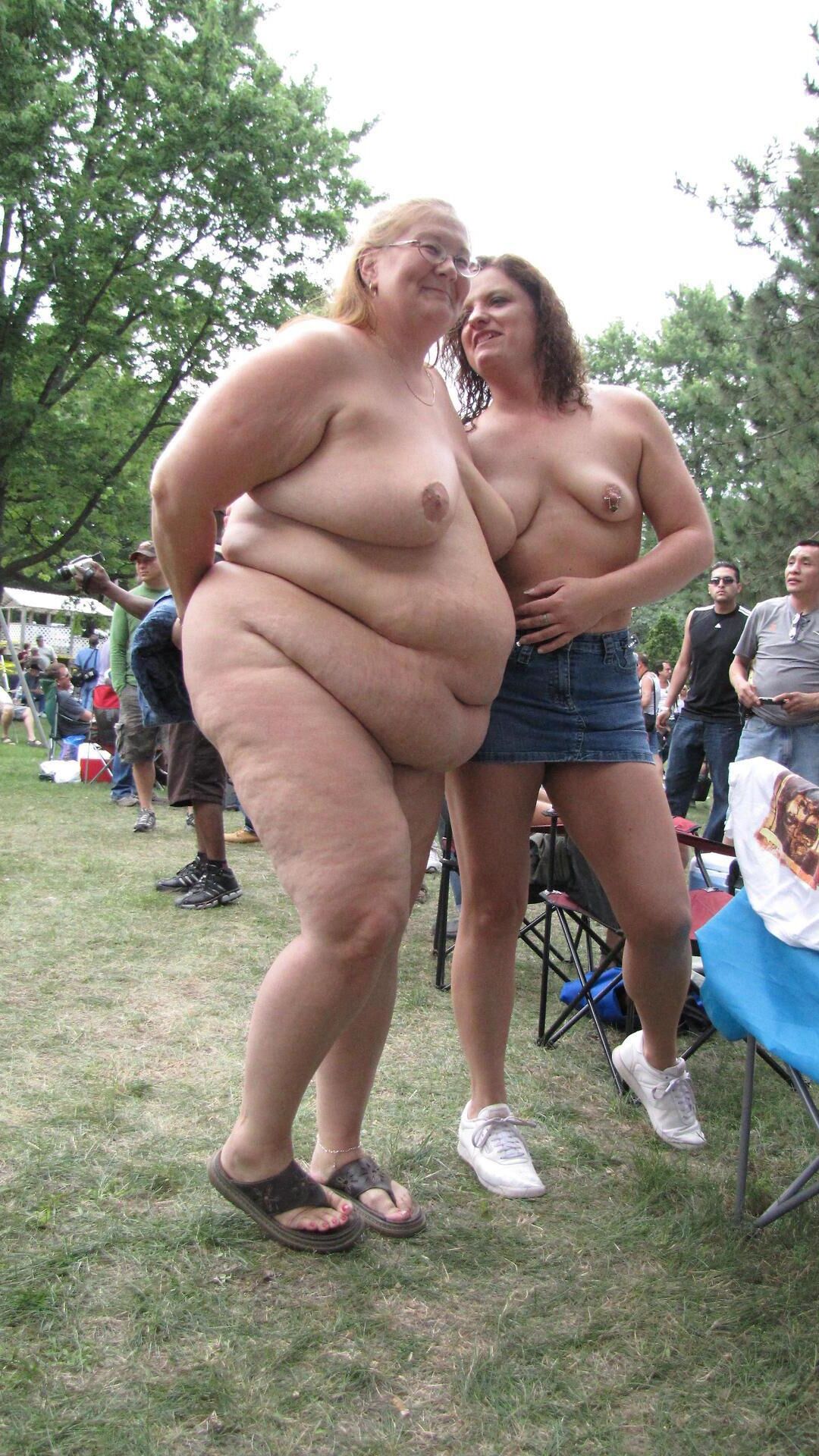 Cellulite asses and thighs ()