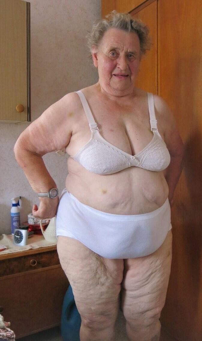Cellulite asses and thighs ()