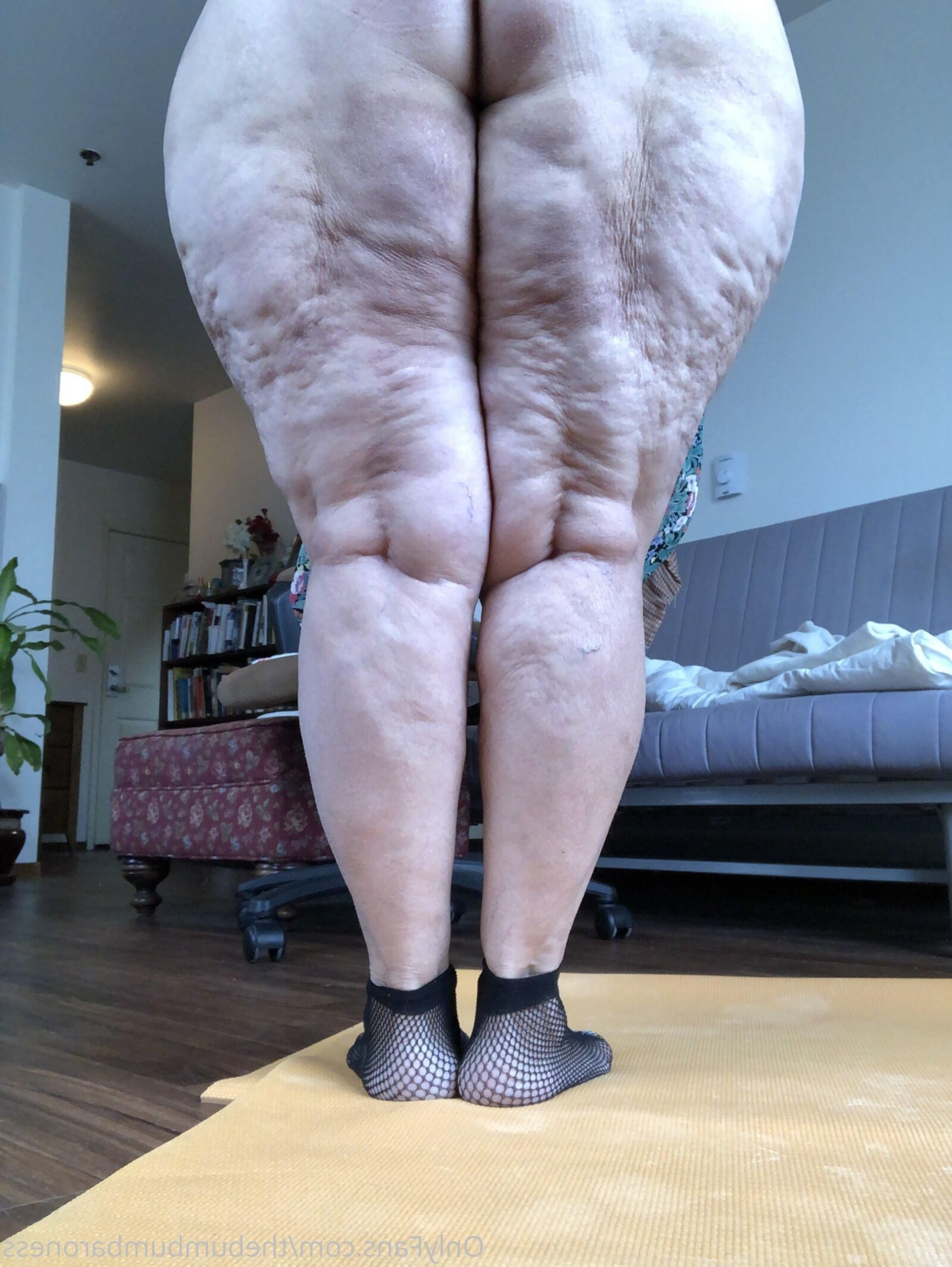 Cellulite asses and thighs ()