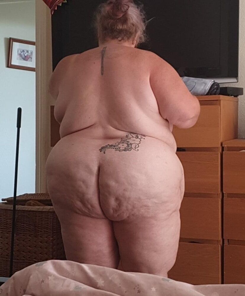 Cellulite asses and thighs ()