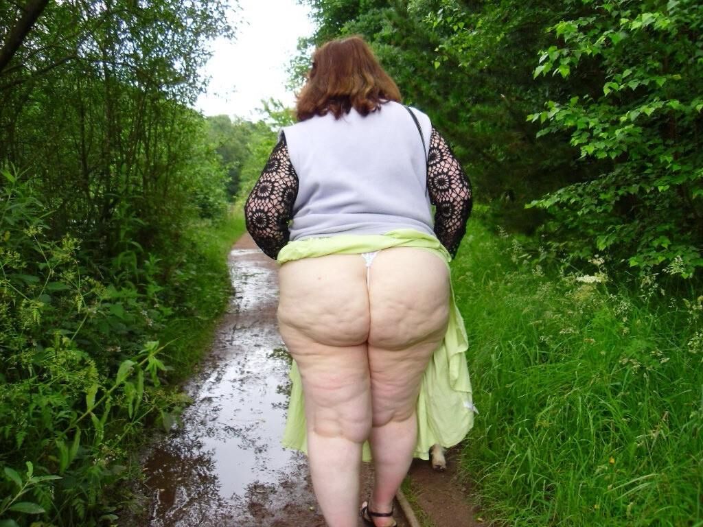 Cellulite asses and thighs ()