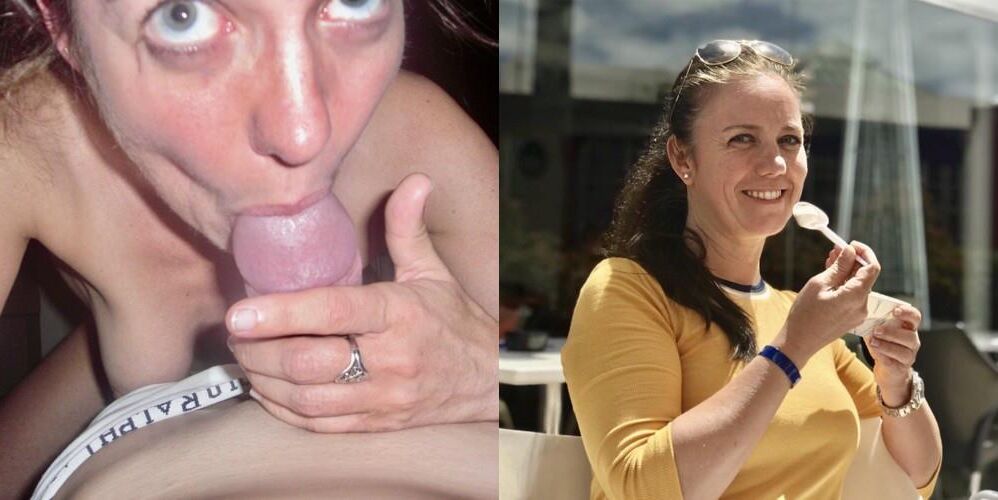 Before and After OMG 