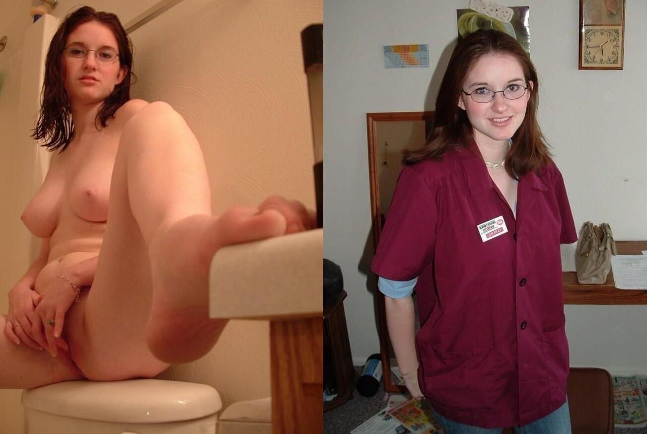 Before and After OMG 