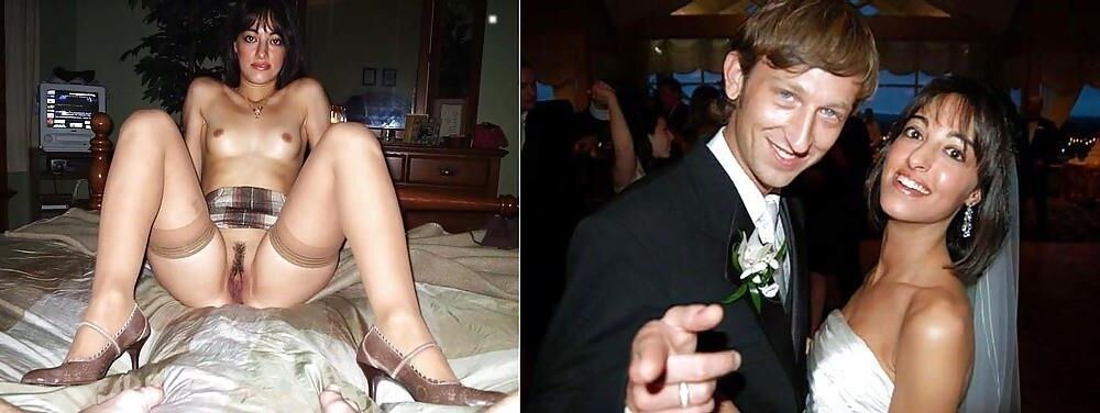 Before and After OMG 