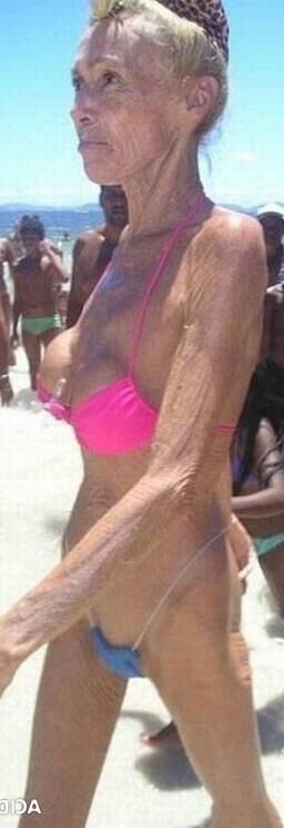 ANOREXIQUE