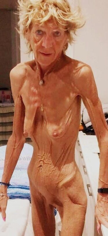 ANOREXIQUE