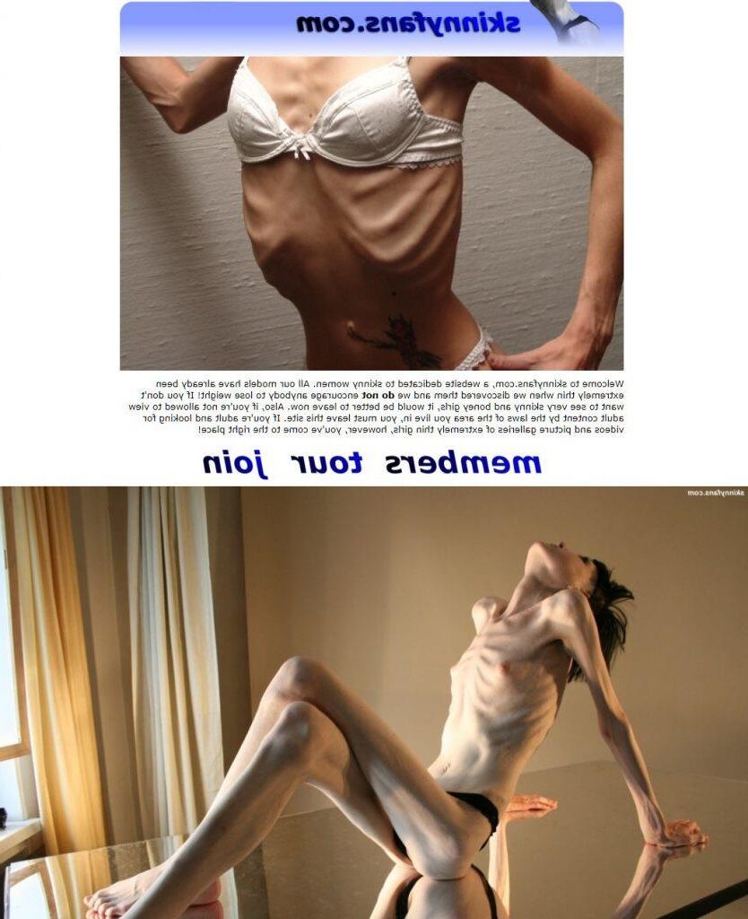 ANOREXIQUE