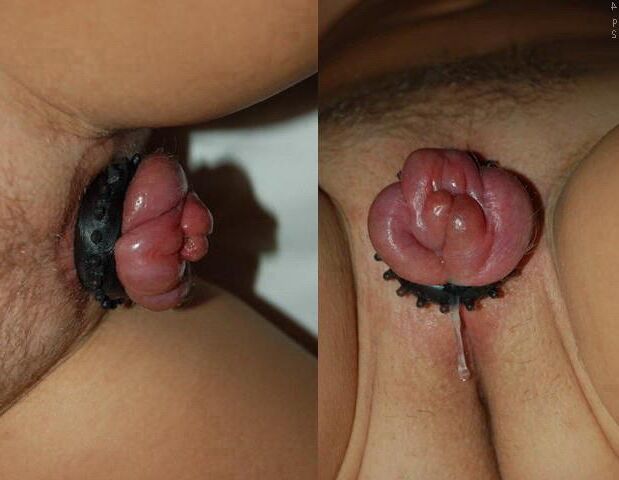 Q PT (WTF)